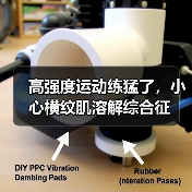 高强度运动练猛了,小心横纹肌溶解综合征(图2) 高强度运动练猛了,小心横纹肌溶解综合征(图2)